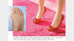 [헬스&뷰티]10㎝ ‘킬힐’…당신은 멋있지만 발은 비명!