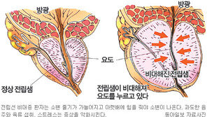 [헬스&뷰티]“옥수수수염, 전립샘 질환에 효과”