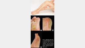 [헬스&뷰티]여름이 좋다… 내발은 예쁘니까