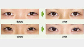 [예쁜 눈 만들기] 고현정, 김혜수, 손담비 이들의 공통점은?