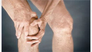 [헬스&뷰티]‘죽음의 덩어리’ 혈전… 어느날 갑자기 혈류가 ‘스톱’