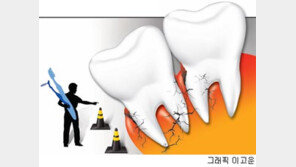 [헬스&뷰티]치주염, 예방 4단계 관리법 <1> 치주병 제대로 알자