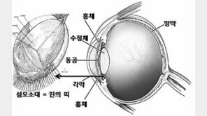[헬스&뷰티]이성진 교수의 아이러브 eye