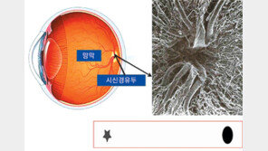 [헬스&뷰티]이성진 교수의 아이러브 eye