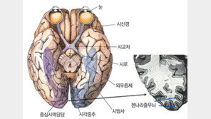 [헬스&뷰티]이성진 교수의 아이러브 eye