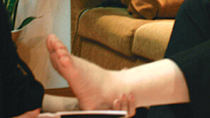 [헬스&뷰티]발 굳은살 제거, 아직도 물에 불려서? 문구용 칼로?