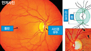 [헬스&뷰티]이성진 교수의 아이러브 eye 
