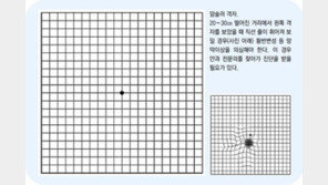 [헬스&뷰티/우리 Eye 1.0 지키기]“똑바로 보이세요?”