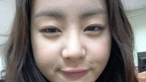 강소라, 뾰루지도 보이는 근접 셀카 “묵언수행 중!”