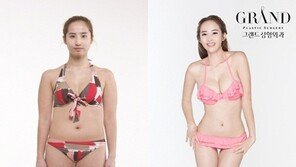 최은, 전신성형 화제… “혹시 포토샵 아니야?”