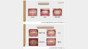 [2012 베스트닥터인터뷰] 잃었던 미소와 자신감을 되찾아주는 치아교정의 힘 - 조헌제 치과