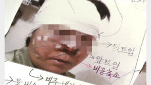 [뉴스A]“외모는 물론 인생까지 잃었다” 성형수술 피해자의 눈물