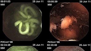뱃속에 들어간 라면, 2시간 지나도 탱탱 “해결책은?”