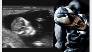 슈퍼악마 태아 사진, 아마도 각도 때문? “아빠 힘내세요”