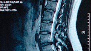 ‘박원순 아들’ 징병검사 MRI 진실은?