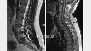 박원순측 “아들 MRI-CT 공개”… 강용석 “다시 촬영해야”