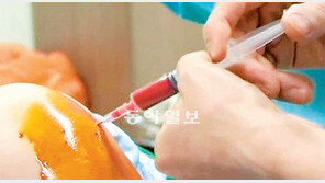 [헬스&뷰티]운동하다 다친 연골, 자가 줄기세포 치료로 재생시킨다