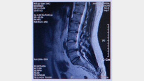 전국의사총연합 “MRI 영상 주인 30,40대일 가능성”