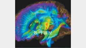 복잡한 뇌 속, 3D로 샅샅이 본다
