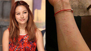 이효리, 채식 부작용? “팔에 알러지가…”