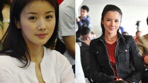中 여배우 손비비, 성형 부작용?… “날이 갈수록 심해지네”