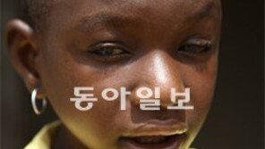 [오늘의 채널A]가나의 열살 소녀, 다시 빛을 볼수있을까