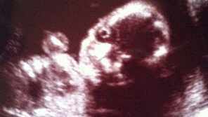 터미네이터 태아, “초음파 사진으로 장난치지마!”