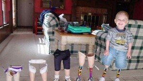 한 아이의 성장 과정 “의족을 보니 가슴이 뭉클”