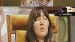 이효리, 비립종 지적에 결국 분노 “짜증나”