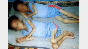 “北식량난 심각…인육 섭취사건 확인돼”