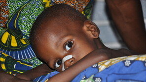 서부 아프리카 사헬, 영양실조 어린이 100만 명!