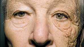 얼굴 절반만 늙은 운전사 “자외선 노출 피해 무시무시해”