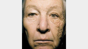 얼굴 절반만 늙은 운전사, “혹시 자외선 차단제 홍보 노리고?”