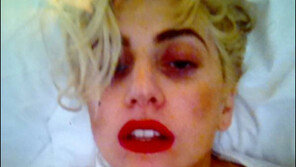 레이디가가 뇌진탕 후유증? 초췌한 얼굴 근황 공개