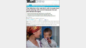 눈 없는 아기 사연 ‘뭉클’…“매일 기적이 일어나길 기도”