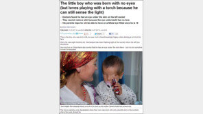 눈 없는 아기 사연, “빛을 보게 되길 기도한다”