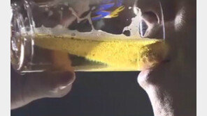 [뉴스A]술 많이 마시면 엉덩이 주저앉는다