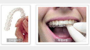 청소년, 성인할 것 없이 투명교정이 대세