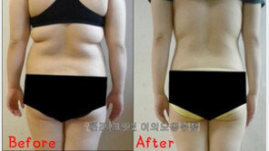 눈에 띄는 미용효과! ‘퀸즈시크릿-여의도동부점’