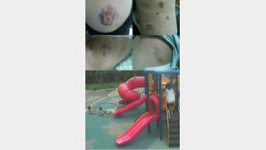 아파트서 진돗개 광란…어린이-임산부 물려