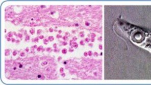 ‘사람 뇌 파먹는’ 아메바 공격에 8세 소년 사망