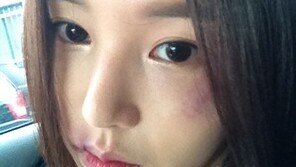 남규리 멍자국 ‘깜짝’… “누가 인형 얼굴에 손을 댔어?”