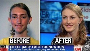 왕따 피하려 성형수술 하는 청소년 이렇게 많다니…