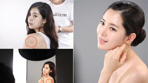 한채아 미모를 모기가 질투했나? ‘모기에 물린 자국 선명’