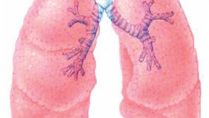 [폐렴 알아야 이긴다]<1> 산소결핍 초래하는 폐 염증