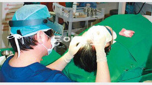 [헬스&뷰티]M자형 탈모, 비절개식 이식으로 해결