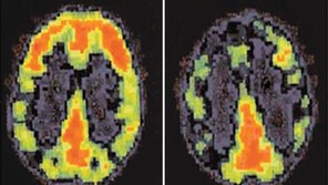 상상조차 힘든 흉악범죄 범인 뇌엔 남다른 비밀이…