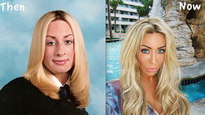 성형 중독 모델의 뒤늦은 후회… “언제나 욕심이 문제!”