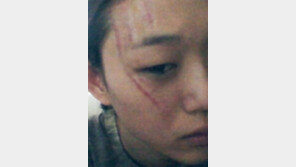 ‘도수코3’ 최소라, 안티팬에 얼굴테러 ‘끔찍’ 