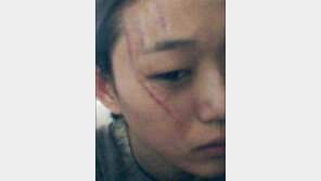 ‘도수코3’ 참가자 최소라 안티팬에게 상처, “마음의 상처가 더 클 듯”